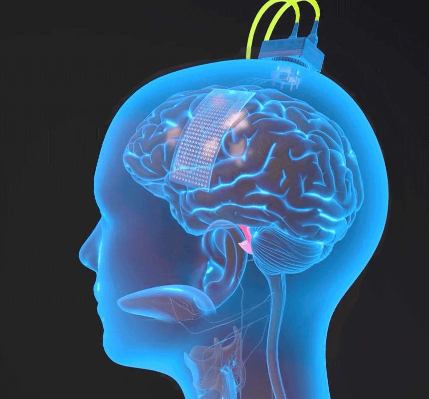 Graphic of a brain with a plug in the head